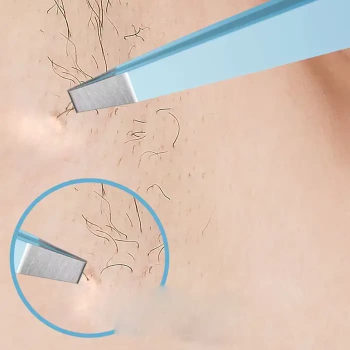 EyeblogugTweezer-Pince à épiler inclinée en acier inoxydable, extracteur de poils fins, pinces à sou