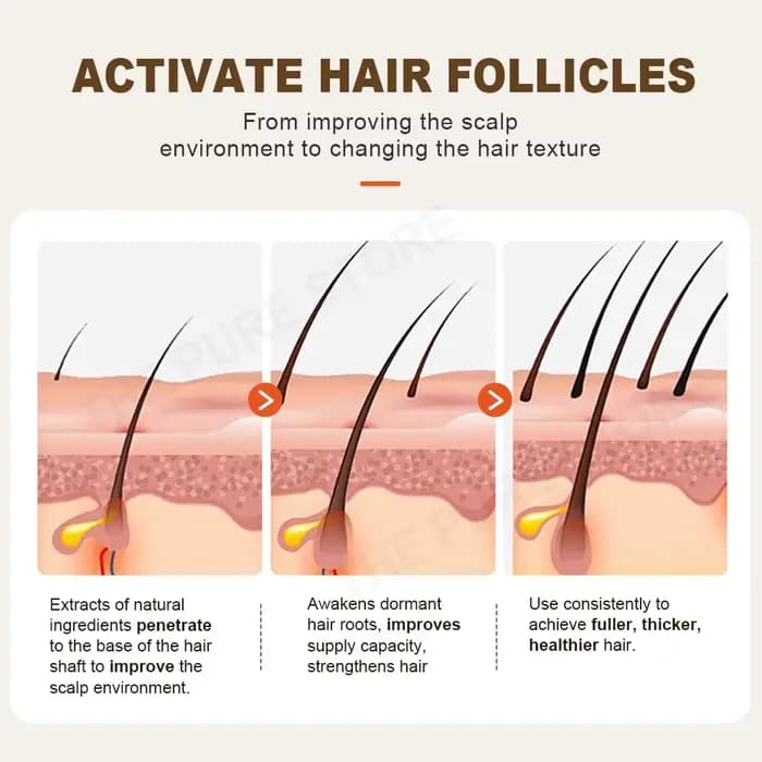 PURC – shampoing au gingembre, traitements contre la perte de cheveux, nourrissant, lissant, épaissi