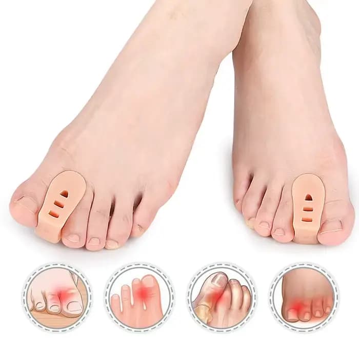 1/5/10 Paires de Séparateurs d'Orteils en Silicone en Forme de A, Correcteur d'Hallux Valgus, Redresseur de Doigts et de Grands-Doigts